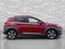 2018 Hyundai Kona Ultimate